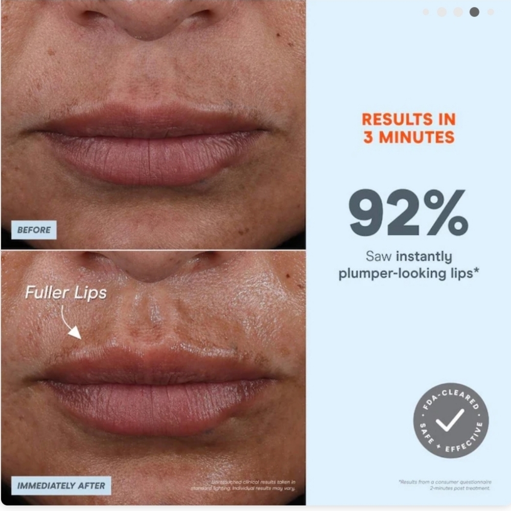 NuFace FIX MicroWand - Sleek White Design - Picture 7 of 16